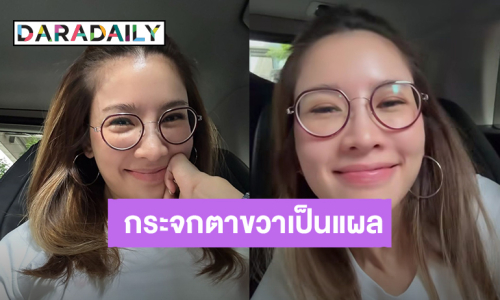 “ไบรท์ พิชญทัฬห์” พักสายตาชั่วคราว กระจกตาขวาเป็นแผล