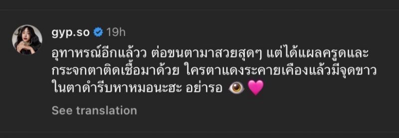 ยิปโซ ต่อขนตา ตาอักเสบ ยิปโซ ต่อขนตา ตาอักเสบ