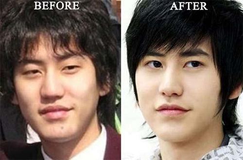 ไอดอล หน้าเปลี่ยน ศัลยกรรม ไอดอล หน้าเปลี่ยน ศัลยกรรม