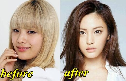 ไอดอล หน้าเปลี่ยน ศัลยกรรม ไอดอล หน้าเปลี่ยน ศัลยกรรม