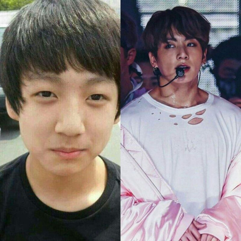 ไอดอล หน้าเปลี่ยน ศัลยกรรม ไอดอล หน้าเปลี่ยน ศัลยกรรม
