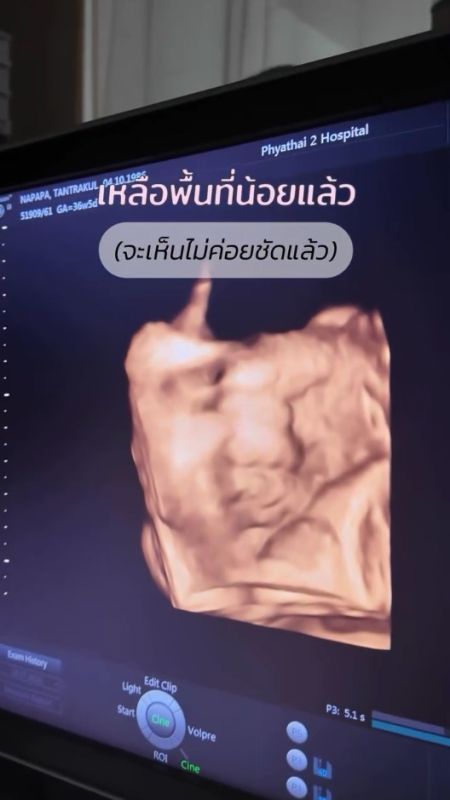 แพท ณปภา