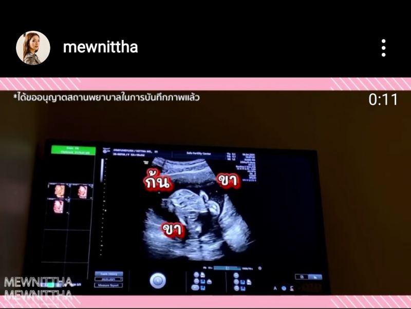 ดารา ท้อง นักแสดง นักร้อง ตั้งครรภ์ ทายาท ปีวัว คุณแม่ คุณพ่อ